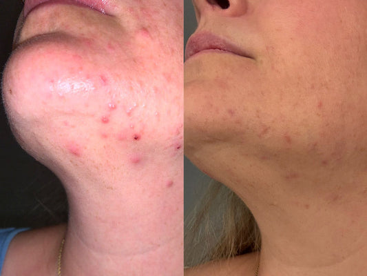 julia skincare testimonial