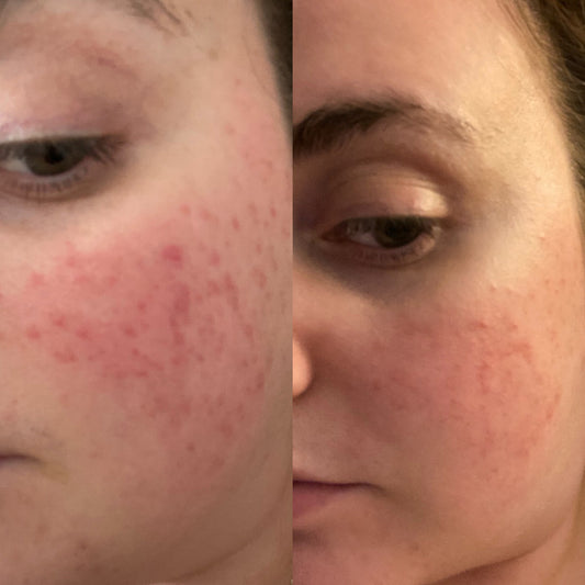 Skincare Review for Lucy Bee