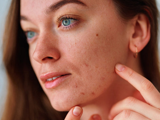 lucy bee core collection for acne prone skin