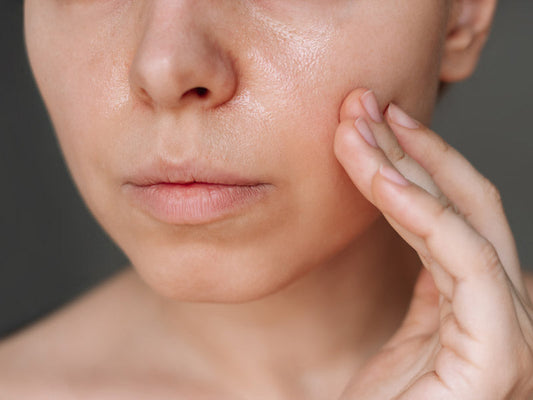 looking after a damaged skin barrier