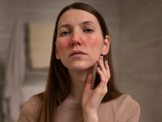 Redness & Rosacea: The Complete Guide