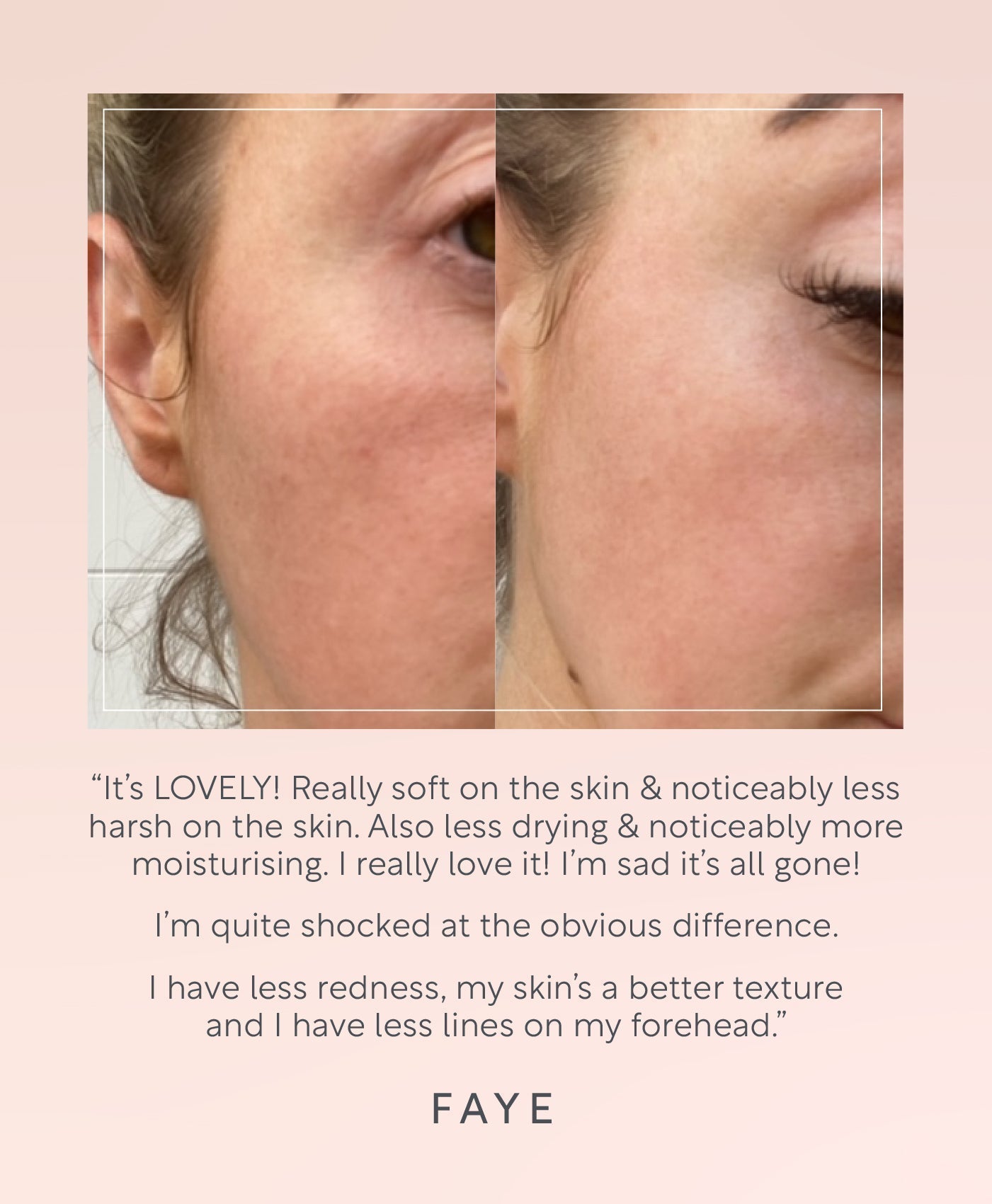 Face Toner for Oily skin by Lucy Bee