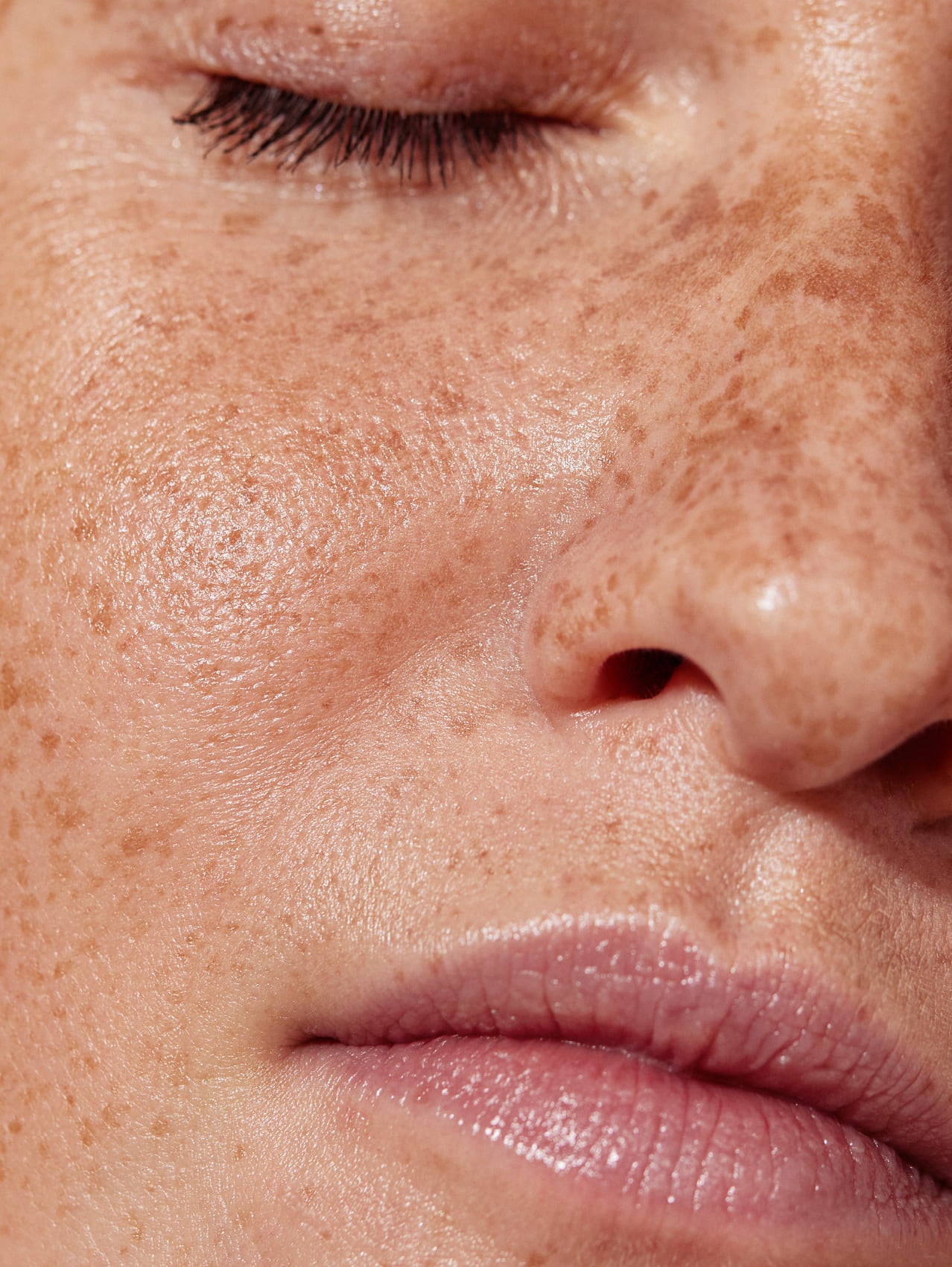 Close-up of a person's face with visible skin texture and freckles.