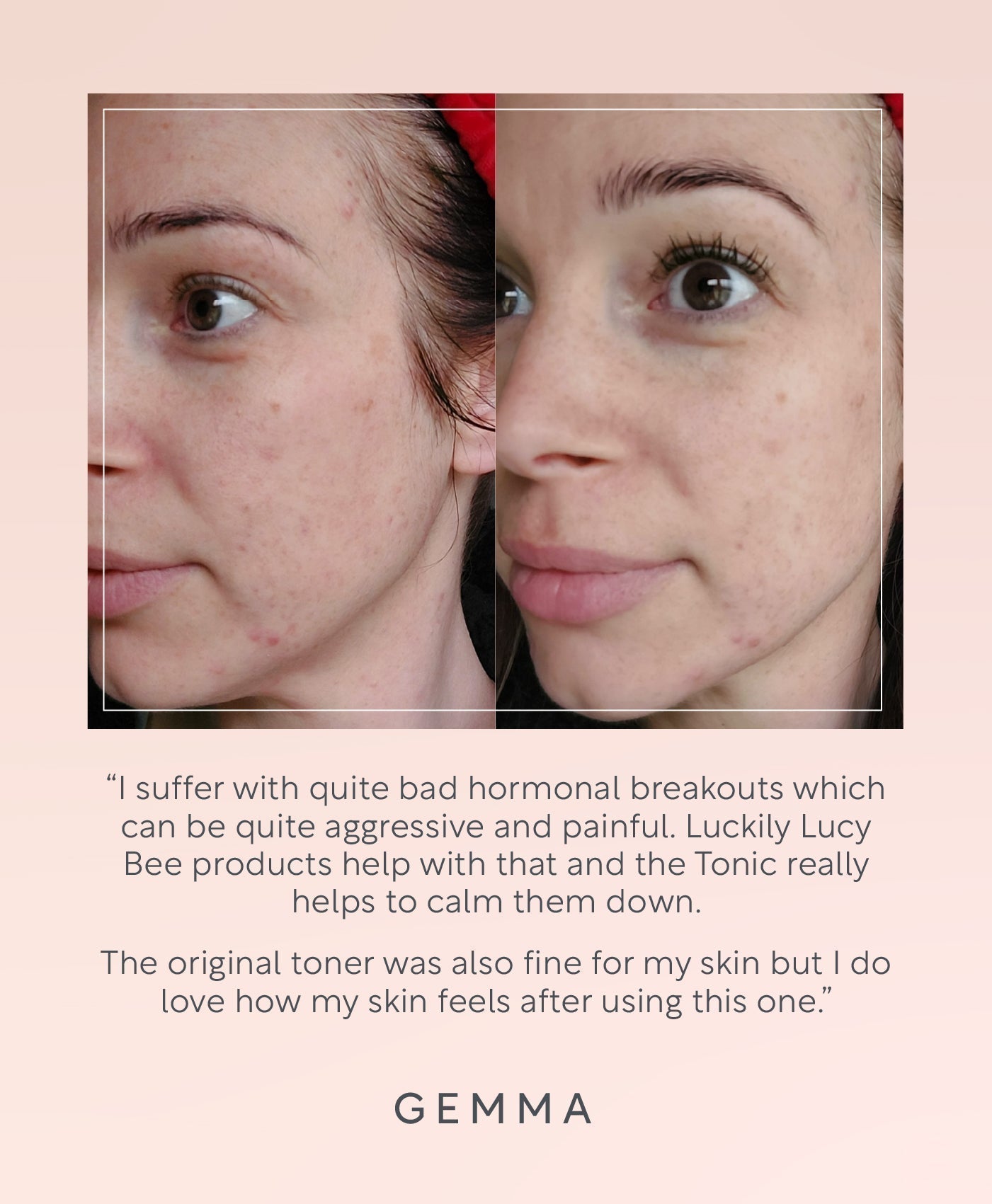 Toner for Dry Skin by Lucy Bee