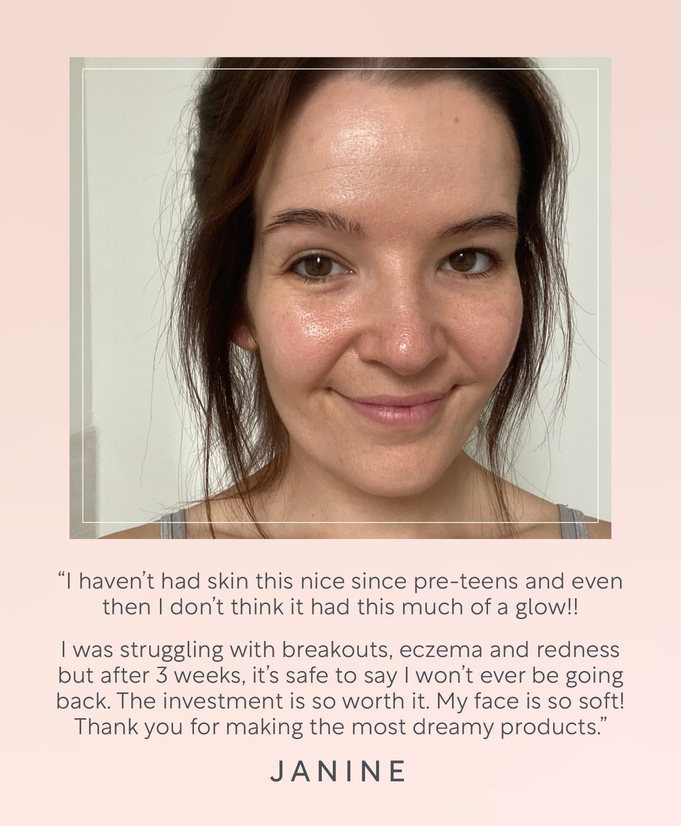 Skincare for dry skin by lucy bee